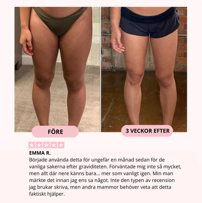 Nordelle Fit™ – Your path to stronger thighs & pelvic floor